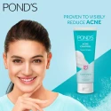 Ponds Acne Control Targets Pimples Face Wash 100g